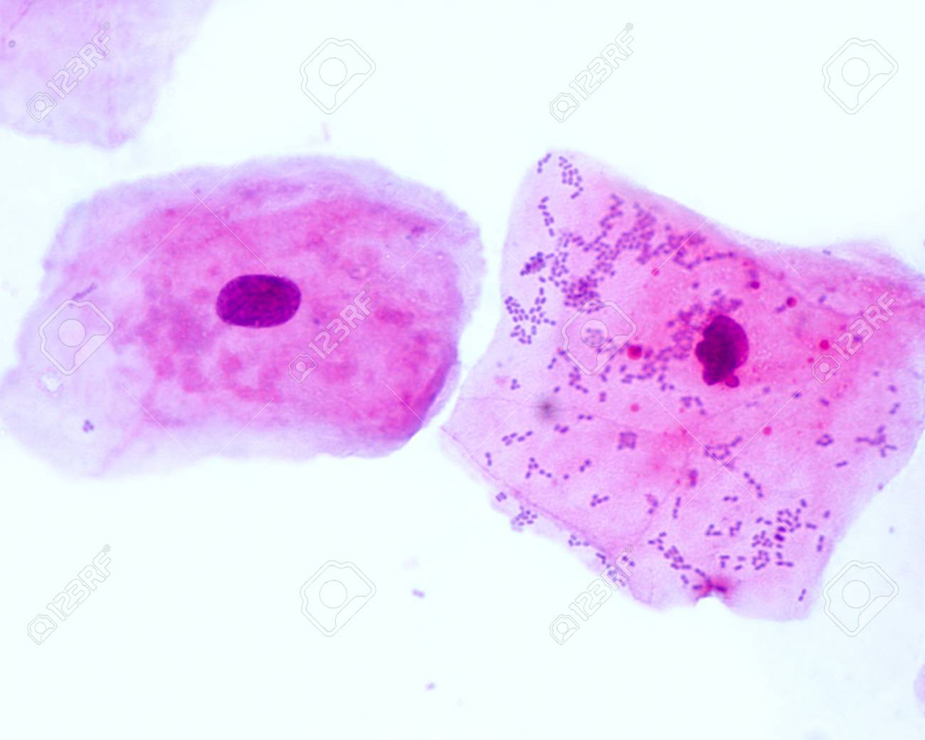 Buccal Smear Showing Squamous Epithelial Cells Exfoliated From Stock Photo Picture And Royalty Free Image Image 97108390