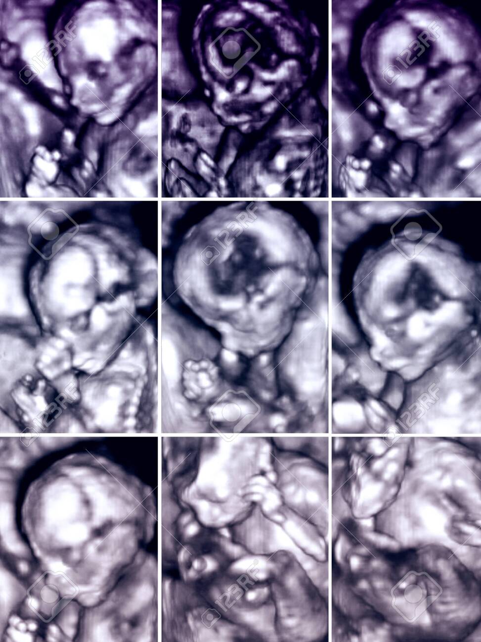 Series of nine 3d fetus ultrasonography pictures. - 123769036