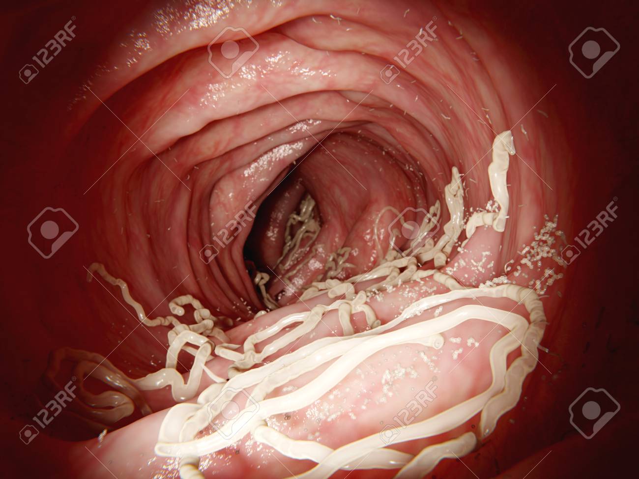 large roundworm in human