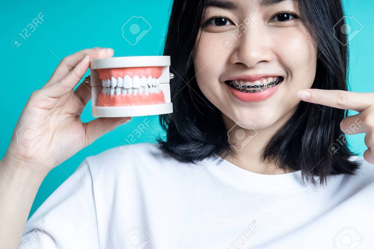 Asian woman wearing detal braces pointing to tooth sample and smiling with her healthy white teeth isolated shot on blue blackground. - 155451783 Asian woman wearing detal braces pointing to tooth sample and smiling with her healthy white teeth isolated shot on blue blackground. - 155451783