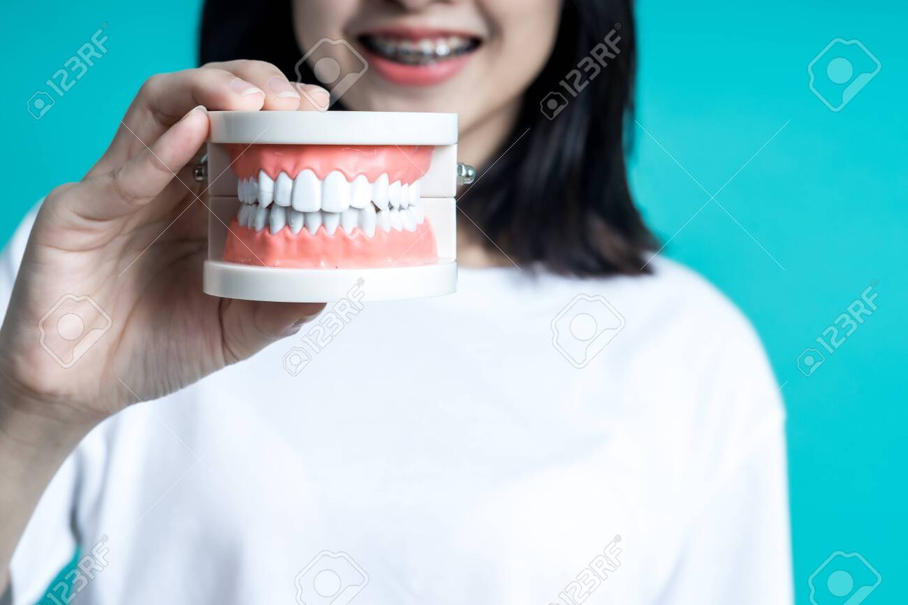 Asian woman wearing detal braces pointing to tooth sample and smiling with her healthy white teeth isolated shot on blue blackground. - 155322333 Asian woman wearing detal braces pointing to tooth sample and smiling with her healthy white teeth isolated shot on blue blackground. - 155322333