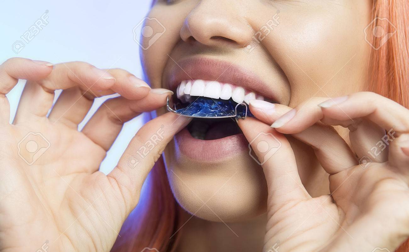 An orthodontist dentist that makes the methods of correcting the wrong bite 55 An orthodontist dentist that makes the methods of correcting the wrong bite 21