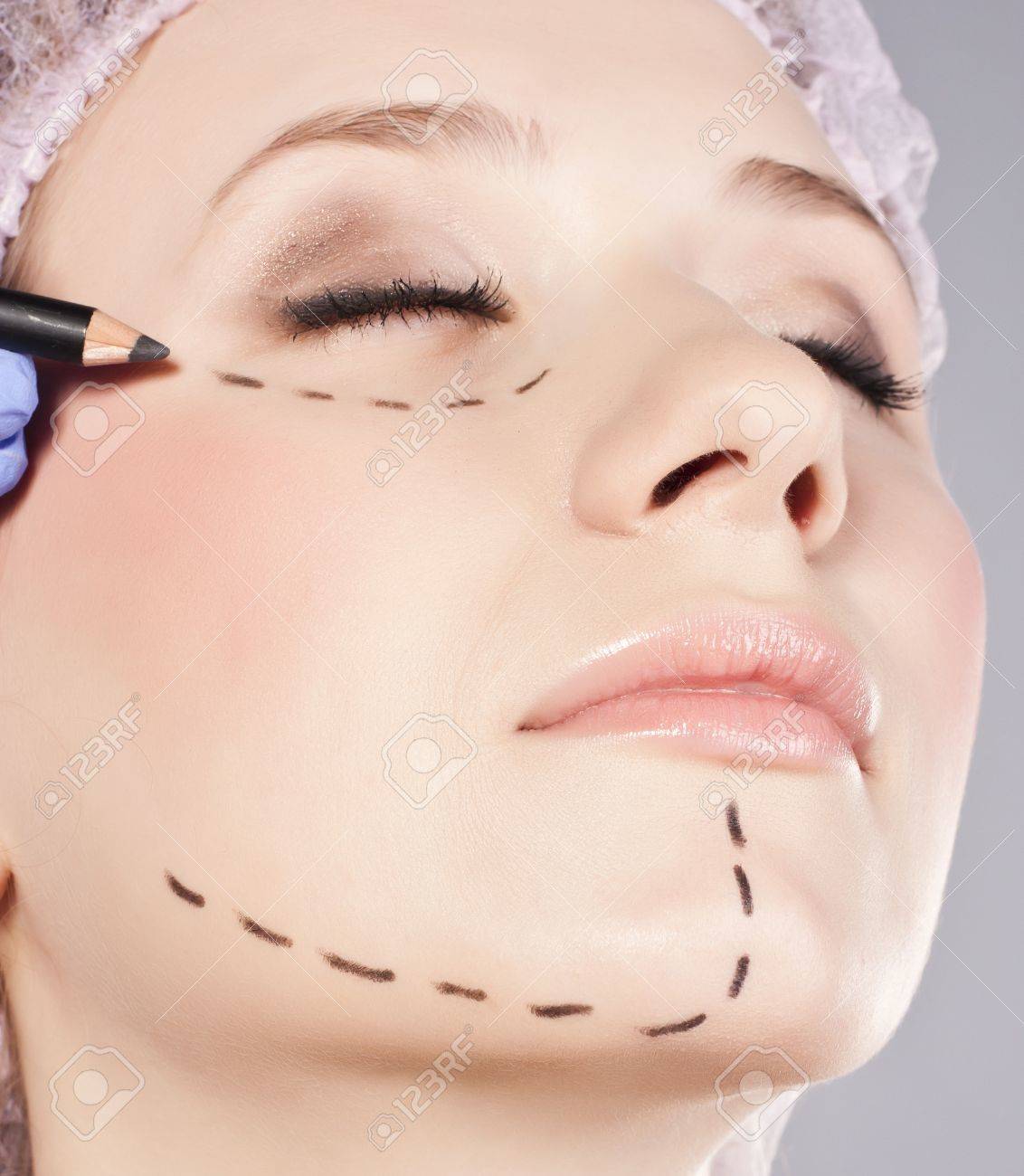 face facial plastic surgery Haley berry nude