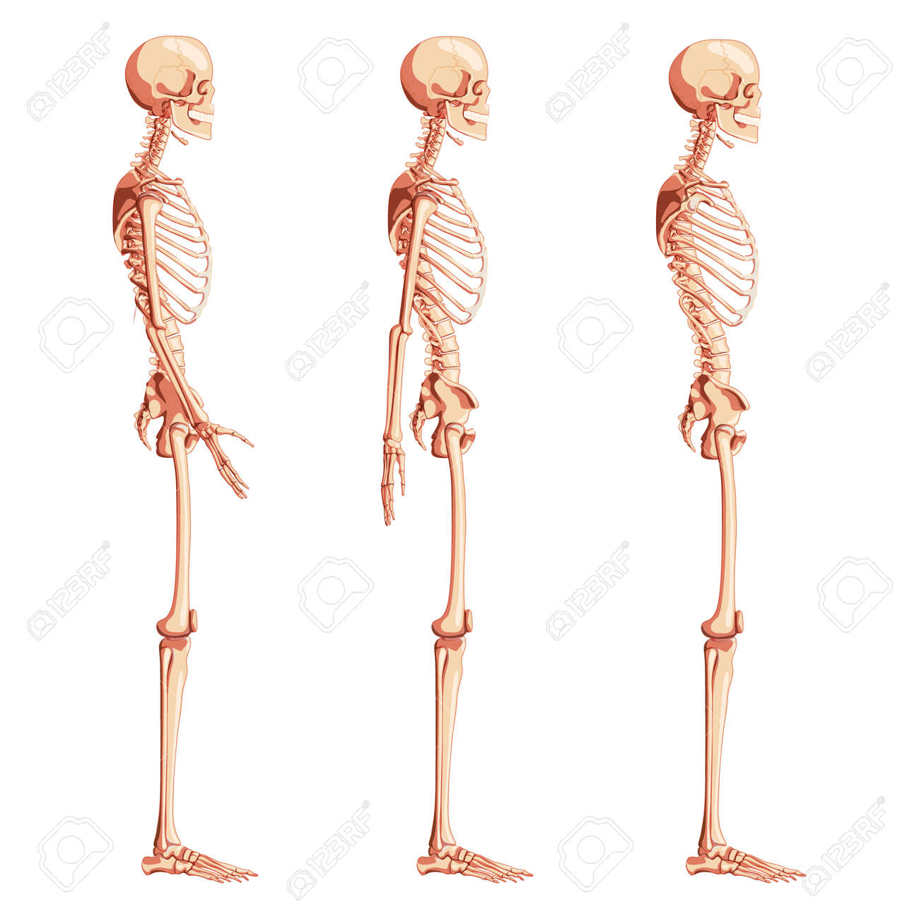 Skeleton Human Dorsal Side View With Armless, Open And Back Arm Poses. Set  Of Realistic Medical Flat Natural Color Concept Vector Illustration  Didactic Board Of Anatomy Isolated On White Background Клипарты, SVG,