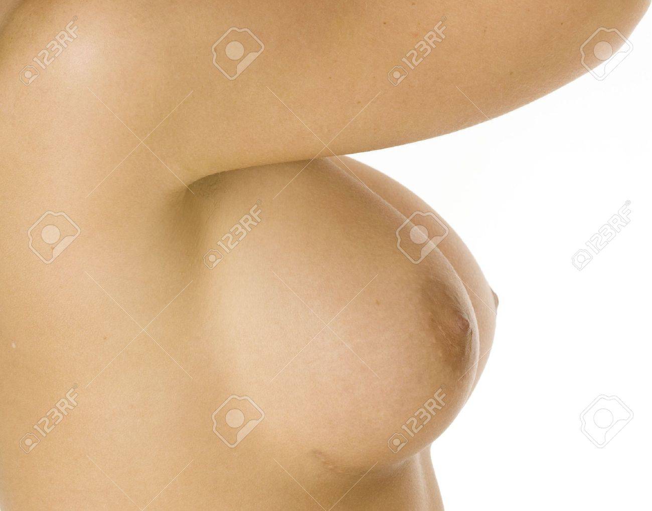 Los Grandes Senos Desnudos Femeninos Mostrando Implante Cicatriz Fotos,  retratos, imágenes y fotografía de archivo libres de derecho. Image 2348032