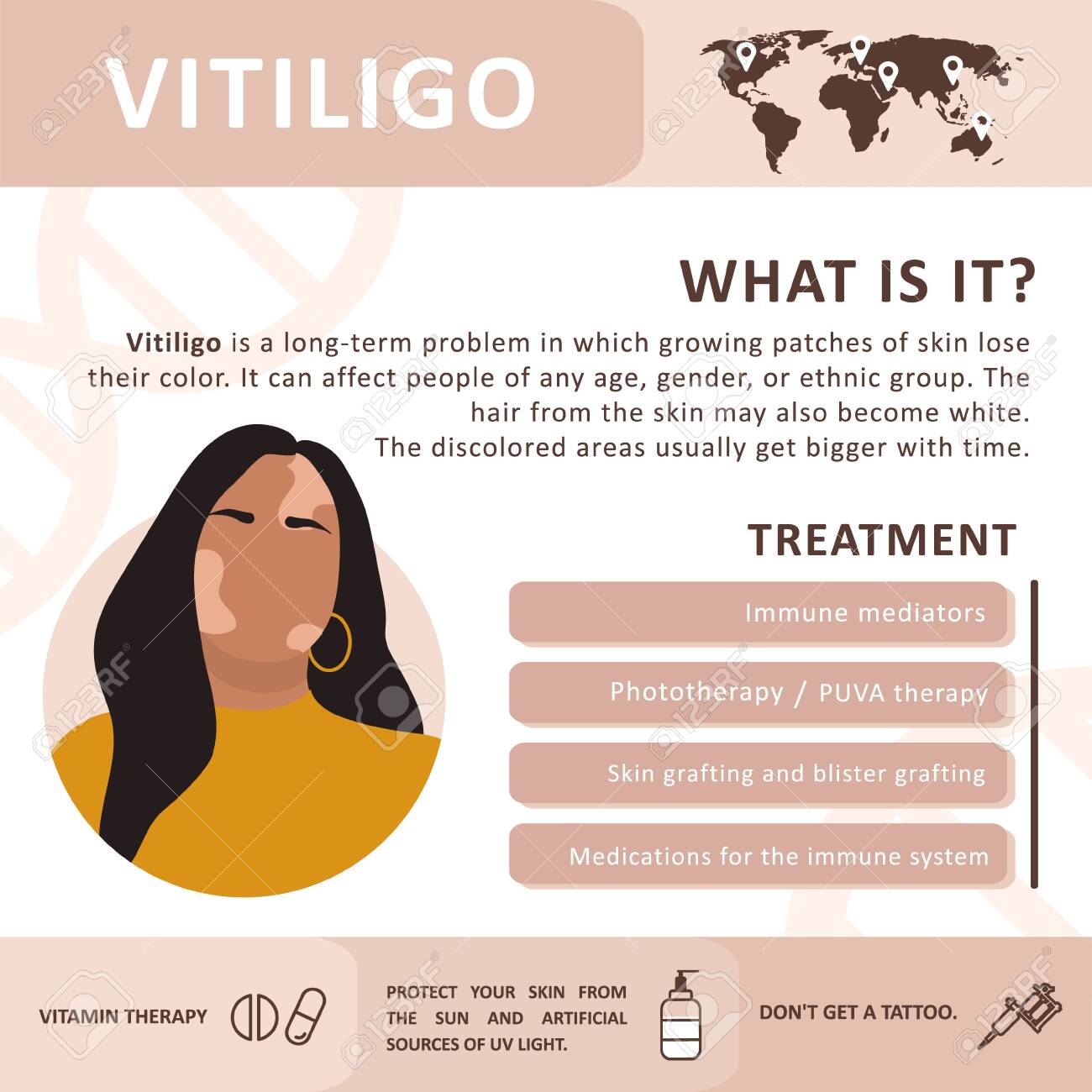 Infographics of vitiligo. Treatment the disease. Abstract woman silhouette. Vector concept to support people living with vitiligo and to build awareness about chronic skin disorder. Self care. - 155270650 Infographics of vitiligo. Treatment the disease. Abstract woman silhouette. Vector concept to support people living with vitiligo and to build awareness about chronic skin disorder. Self care. - 155270650