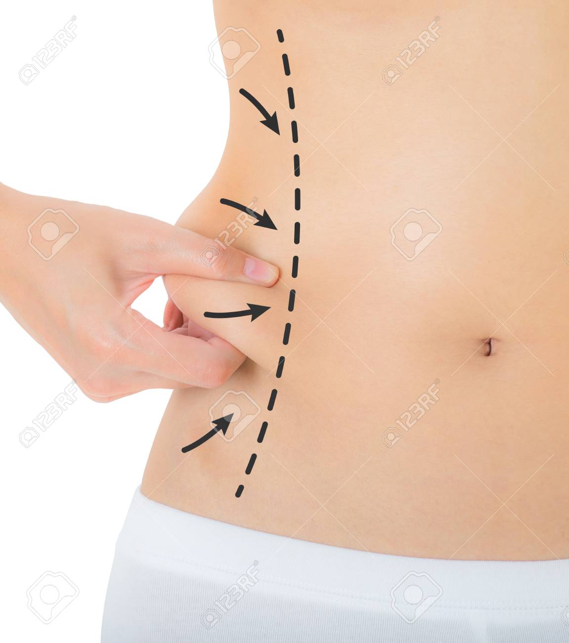 Adelgazar los flancos abdominales Adelgazar los flancos abdominales