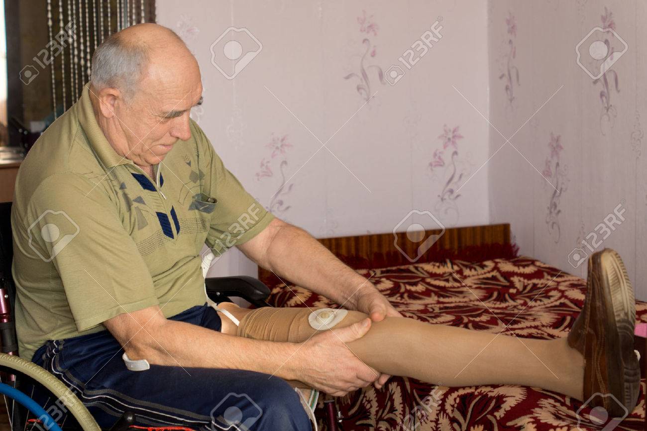 義足に電子センサーを取り付ける彼の車椅子に座って彼の義足の継手高齢者の切断 の写真素材 画像素材 Image