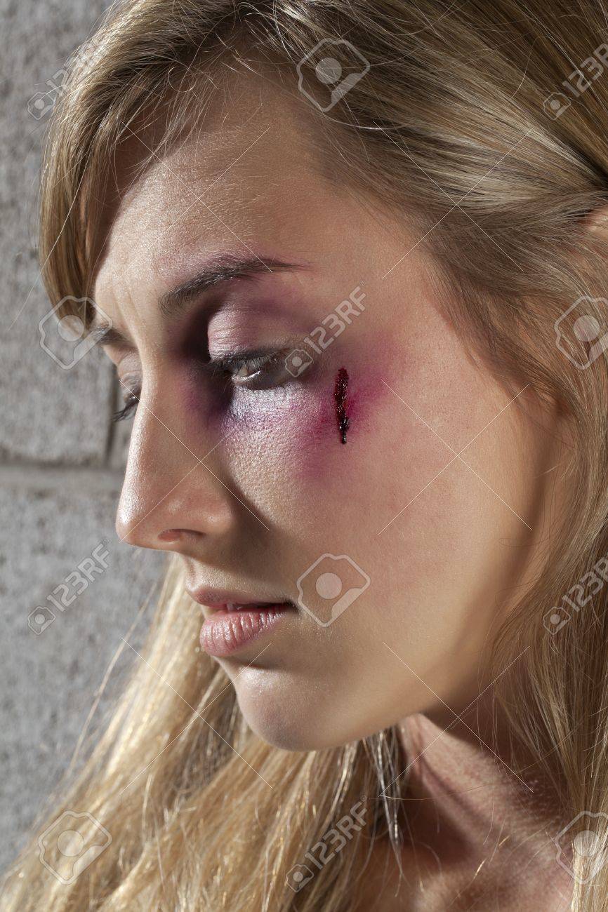 黒眼とクローズ アップのイメージで女性の傷 の写真素材 画像素材 Image