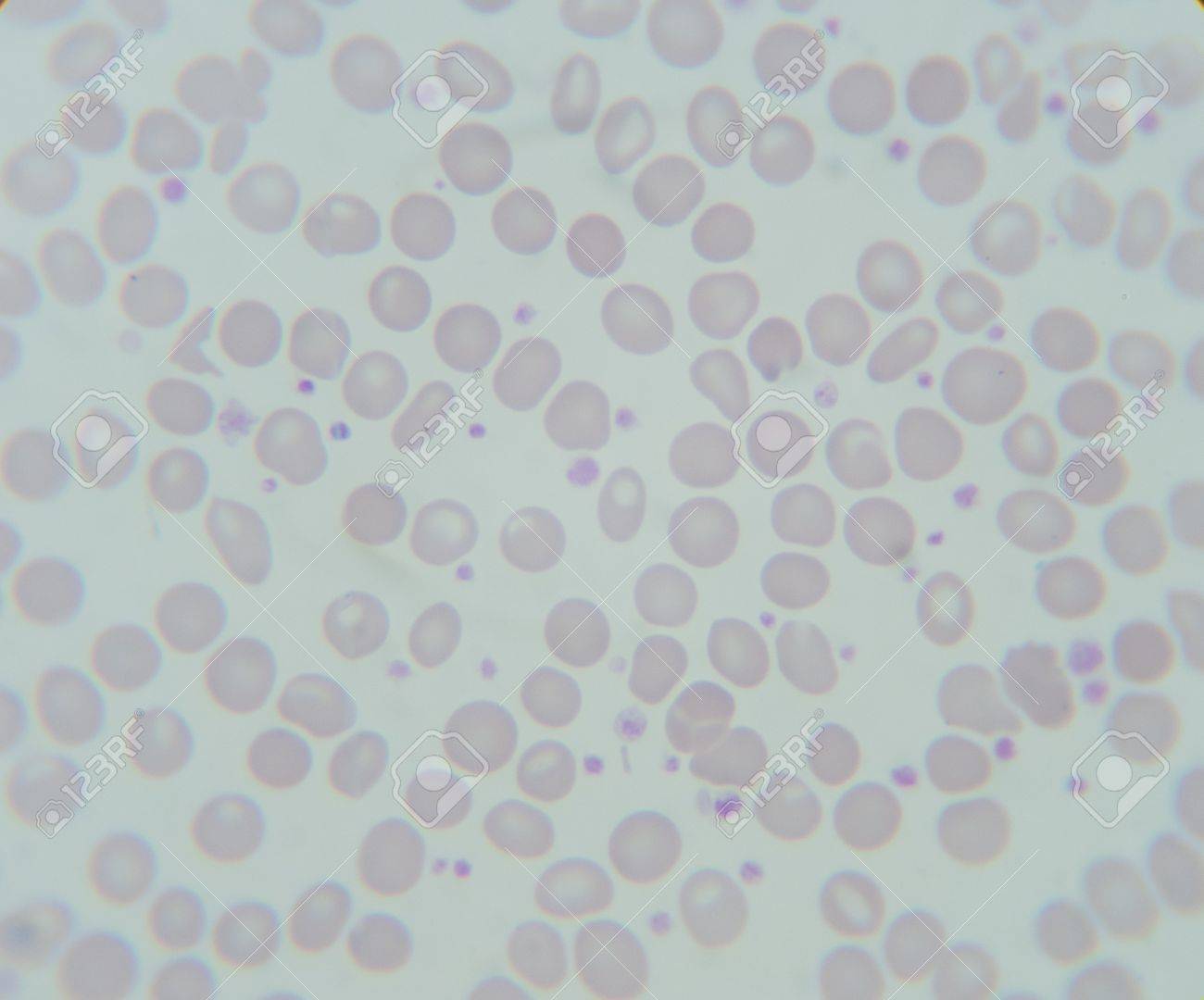 diapositivas de sangre fotos que muestran parásitos