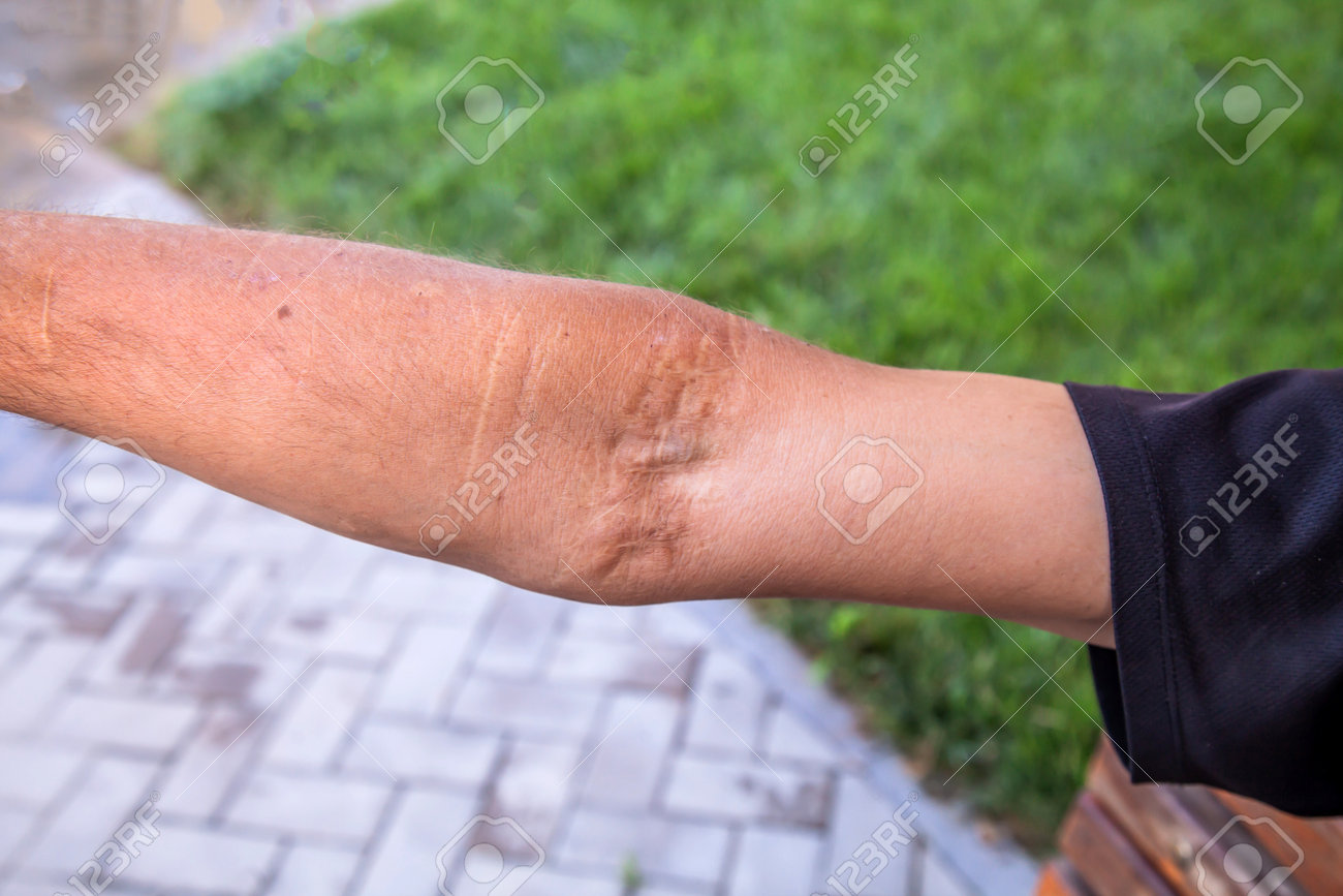 etiam-dictum-ipsum-a-felis