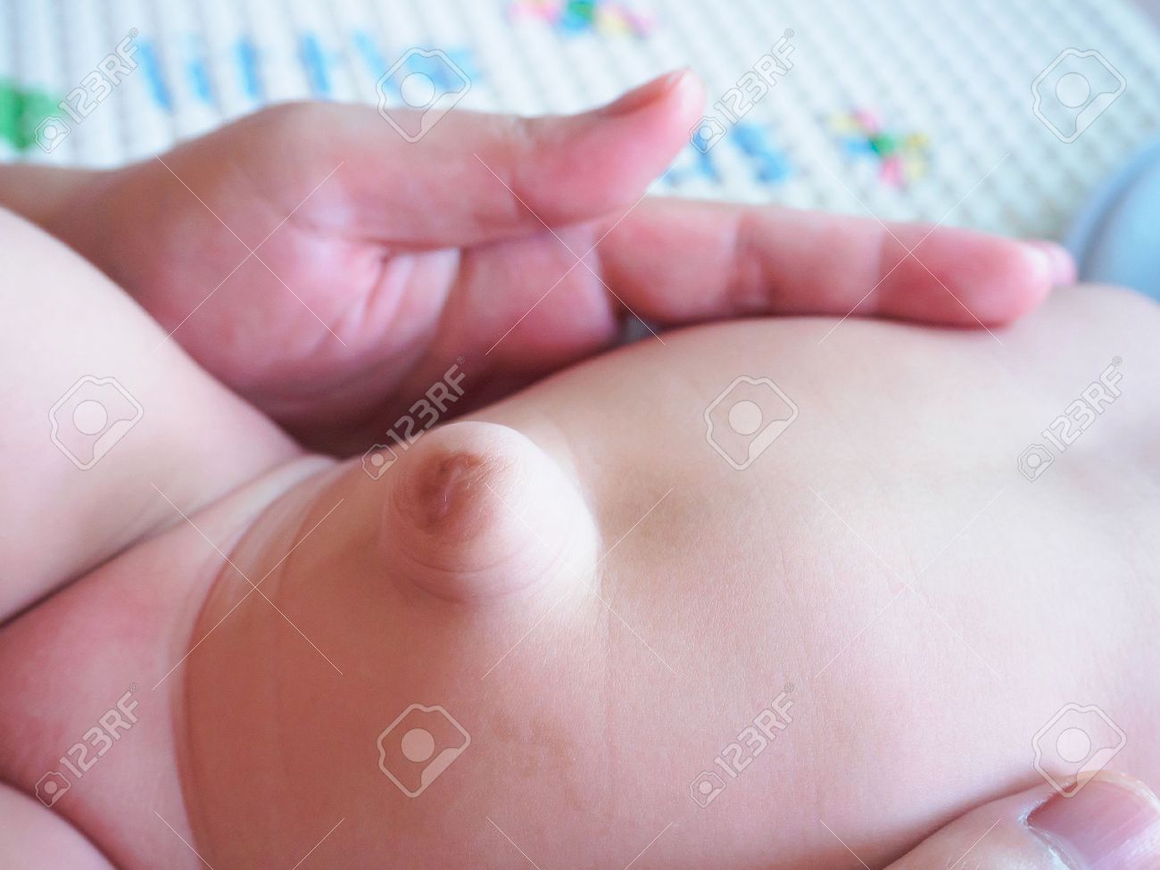 Umbilical hernia in baby hi-res stock photography and images - Alamy