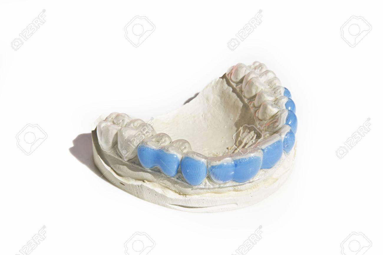 plaster mold of the dental arch with a silicone custom stock photo dental arch