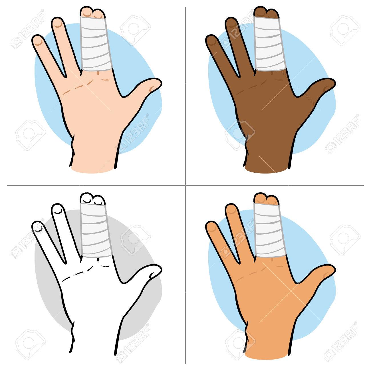 人間の手の指でのイラストは 包帯 民族で群生 カタログに最適な情報と応急処置ガイドします のイラスト素材 ベクタ Image
