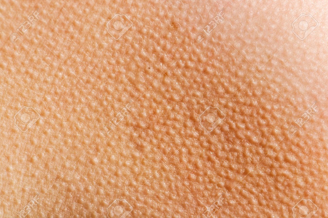 人間の皮膚は寒さから鳥肌と の写真素材 画像素材 Image