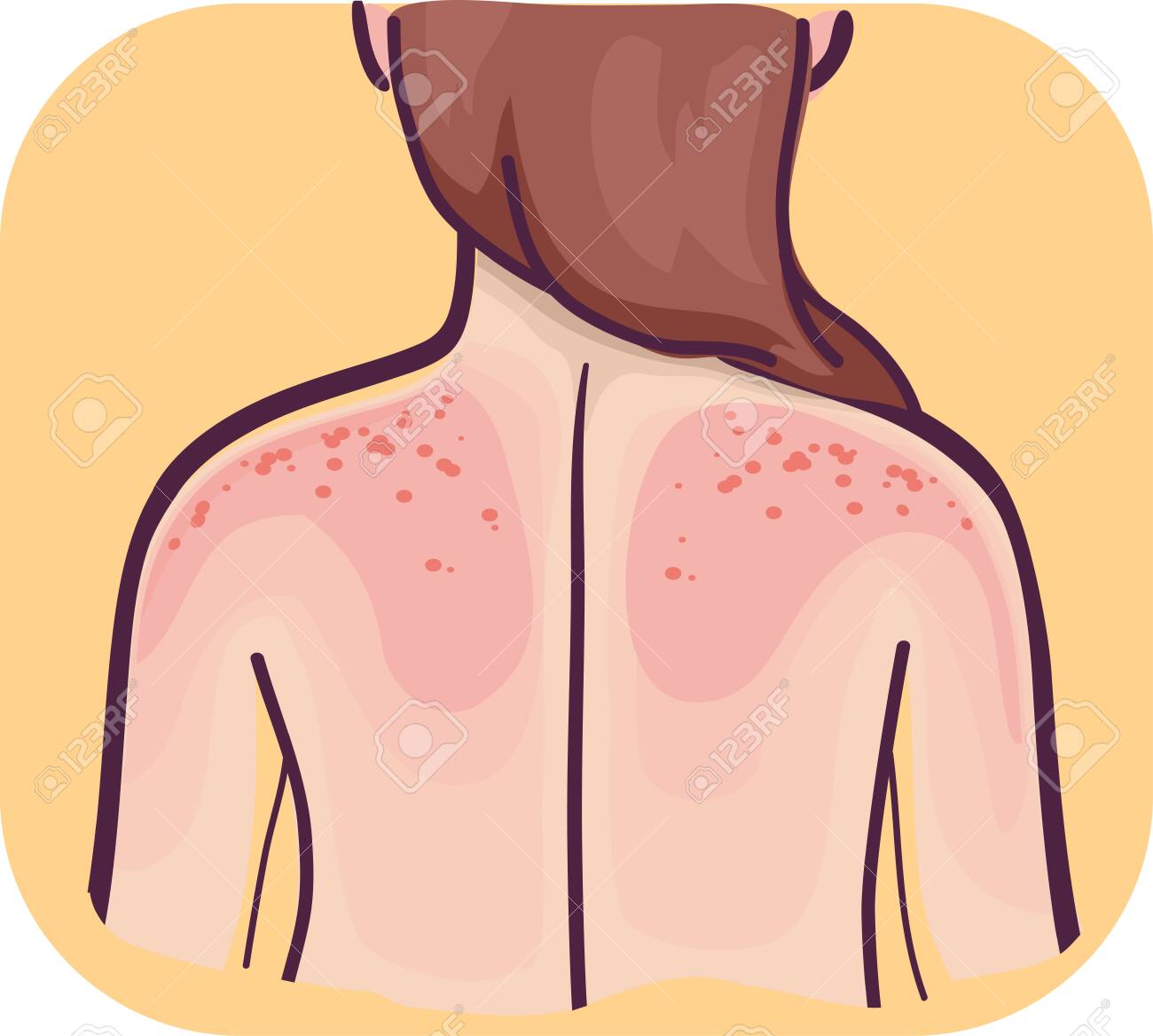 sensitive skin on back