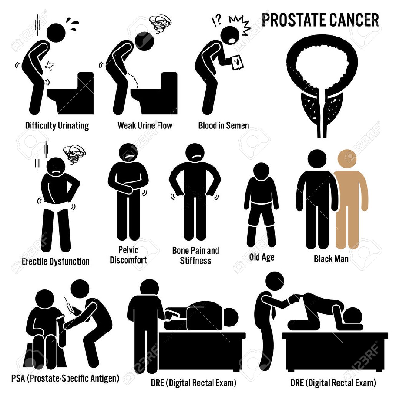 síntoma de cancer de próstata