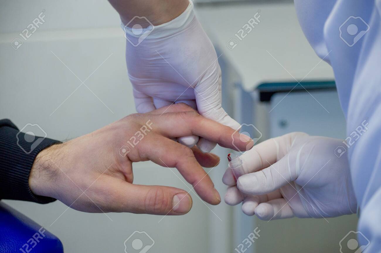 Man gives blood. Blood is taken from a man for analysis from a finger in a specialized medical laboratory. Treatment, virus, health. The concept of medicine, people's health. Finger blood, test tube - 143063940 Man gives blood. Blood is taken from a man for analysis from a finger in a specialized medical laboratory. Treatment, virus, health. The concept of medicine, people's health. Finger blood, test tube - 143063940