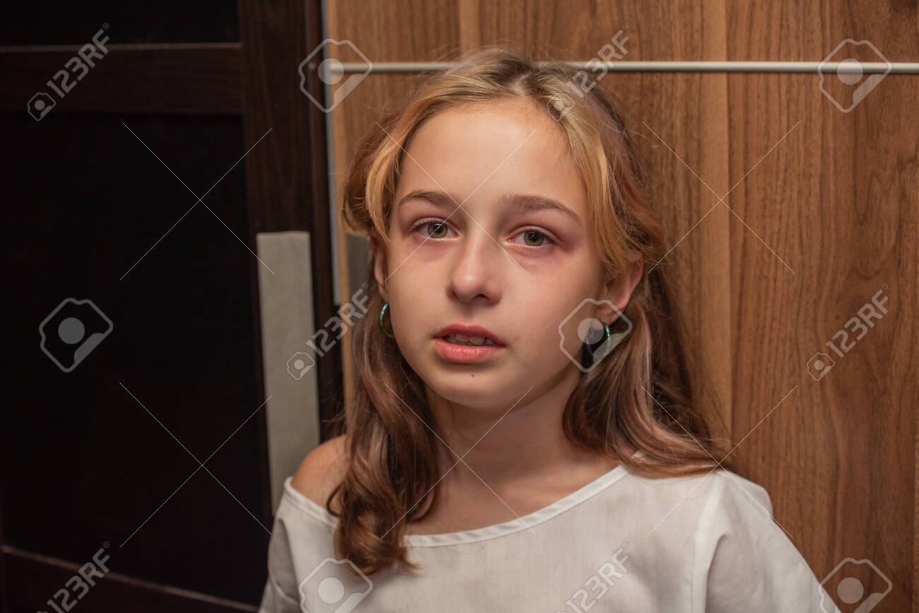 Cute Little Kid Is Crying. Girl Crying. Portrait Of A Sad Child ...