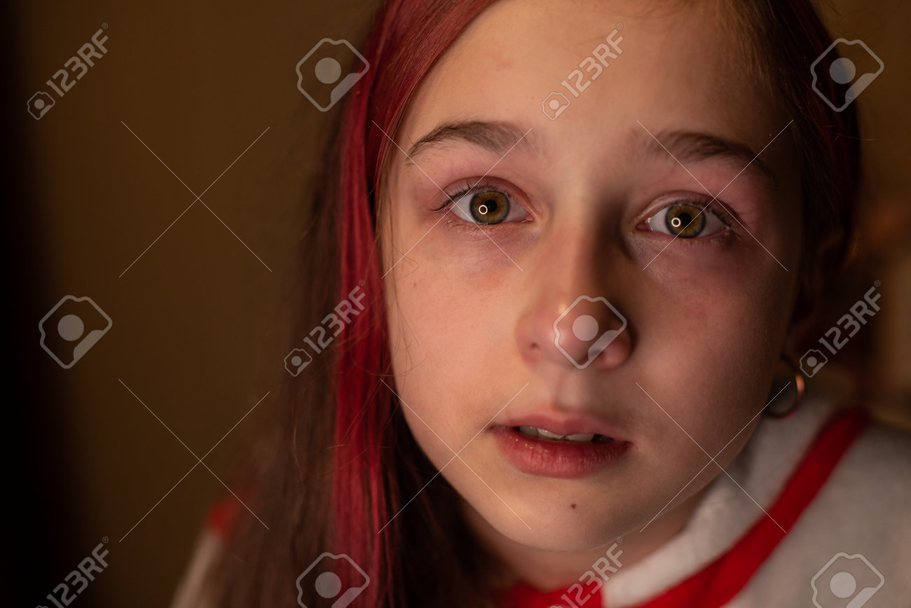 少女　体液 虐待された、十代の感情的な感情的な肖像画。涙と若い泣いている女の子のクローズアップの肖像画。の写真素材・画像素材 Image 160459926