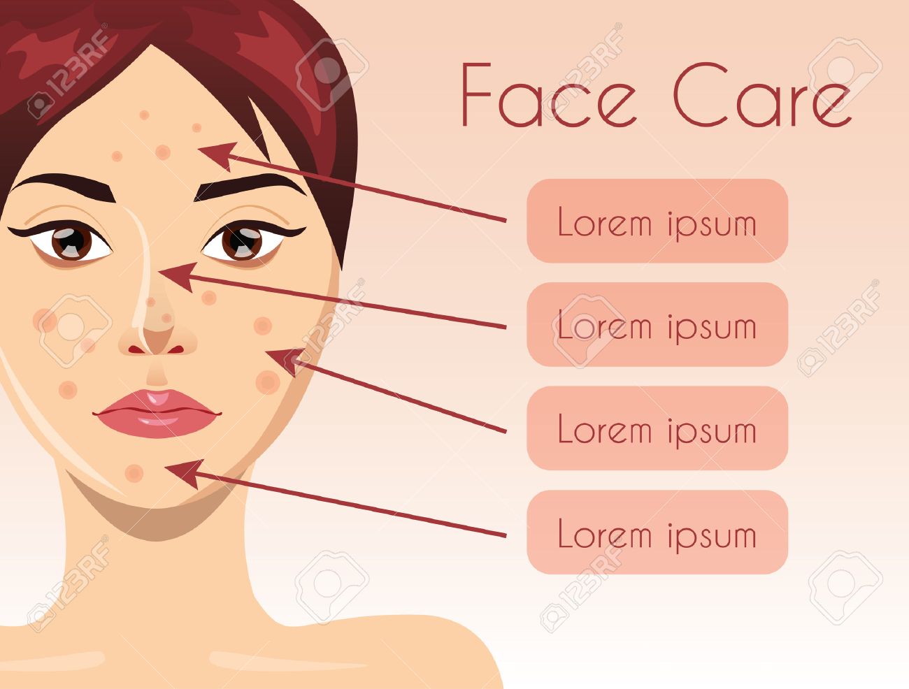 acne treatment for women