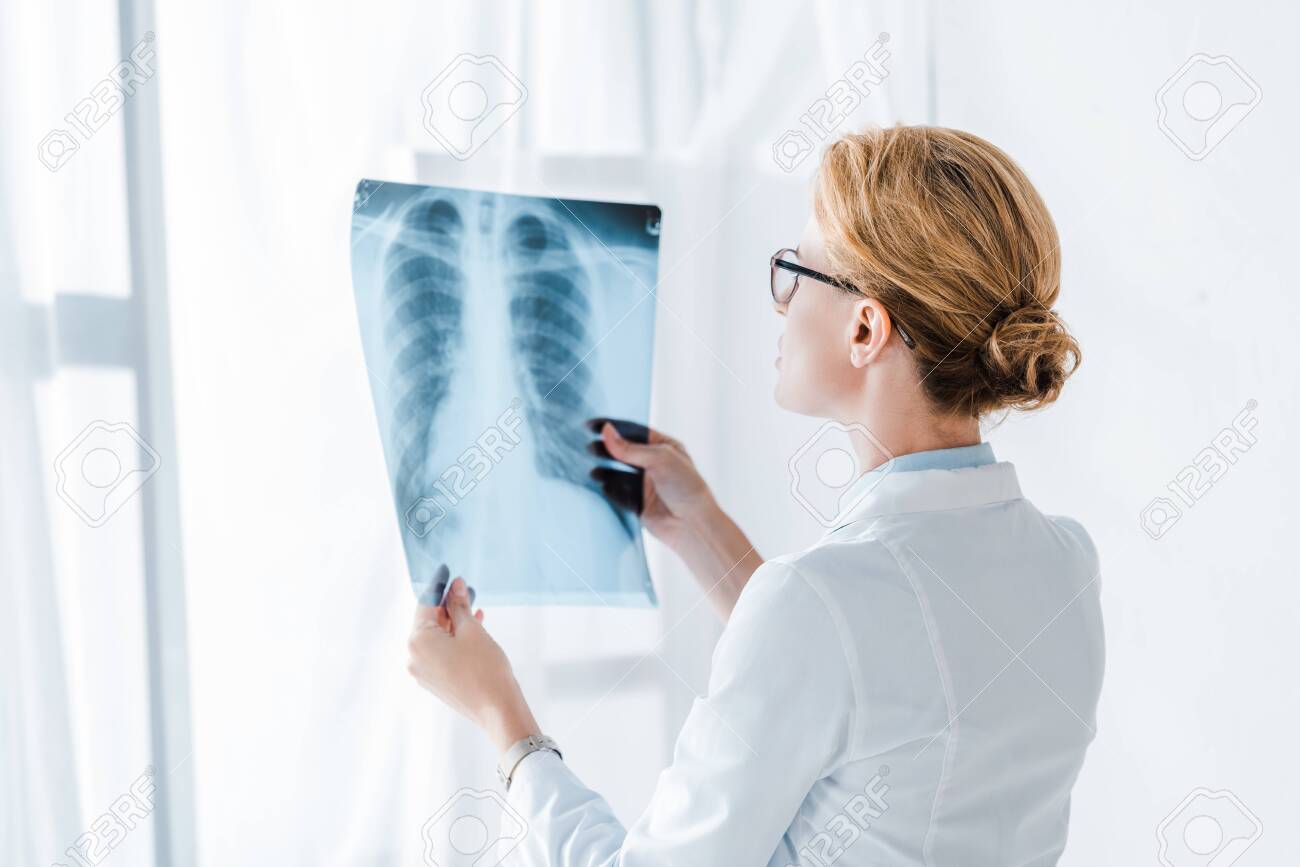 doctor in glasses looking at x-ray while standing in clinic - 131825965 doctor in glasses looking at x-ray while standing in clinic - 131825965