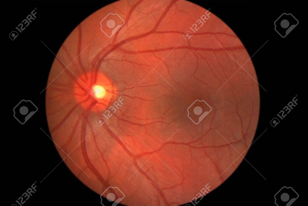retina human eye showing optic nerve and macula stock photo