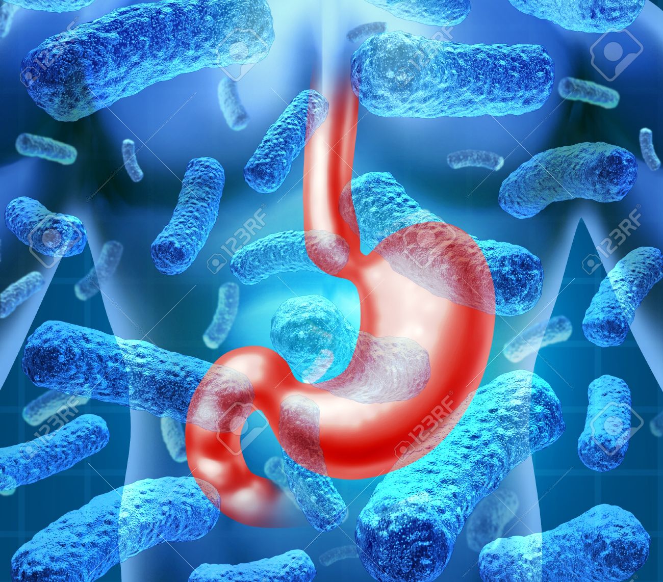 gastroenteritis viral (gripe estomacal) tratamiento