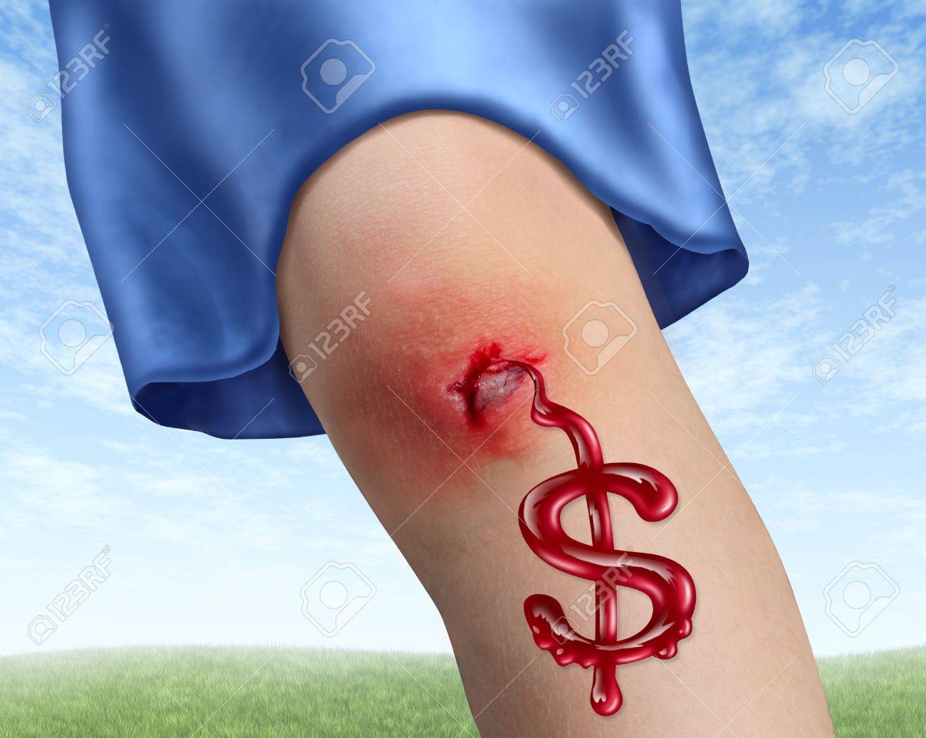 Medical Accident Insurance Costs With A Human Child Knee Bleeding Blood In  The Shape Of A Dollar Sign As A Health Care Concept For Hospital Fees And  Accidental Physical Injury On A