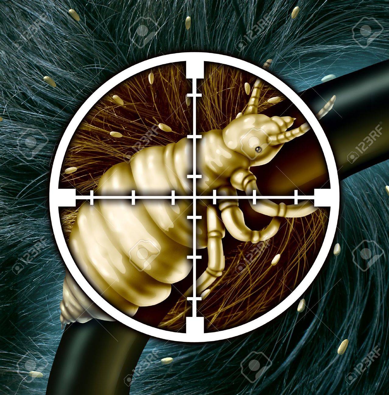 シラミを殺す寄生シラミや感染症と治療へのソリューションのための記号として孵化の卵のインフェ ステーションと十字ターゲットのシラミ昆虫の 閉じると医療概念として髪の問題を排除します の写真素材 画像素材 Image