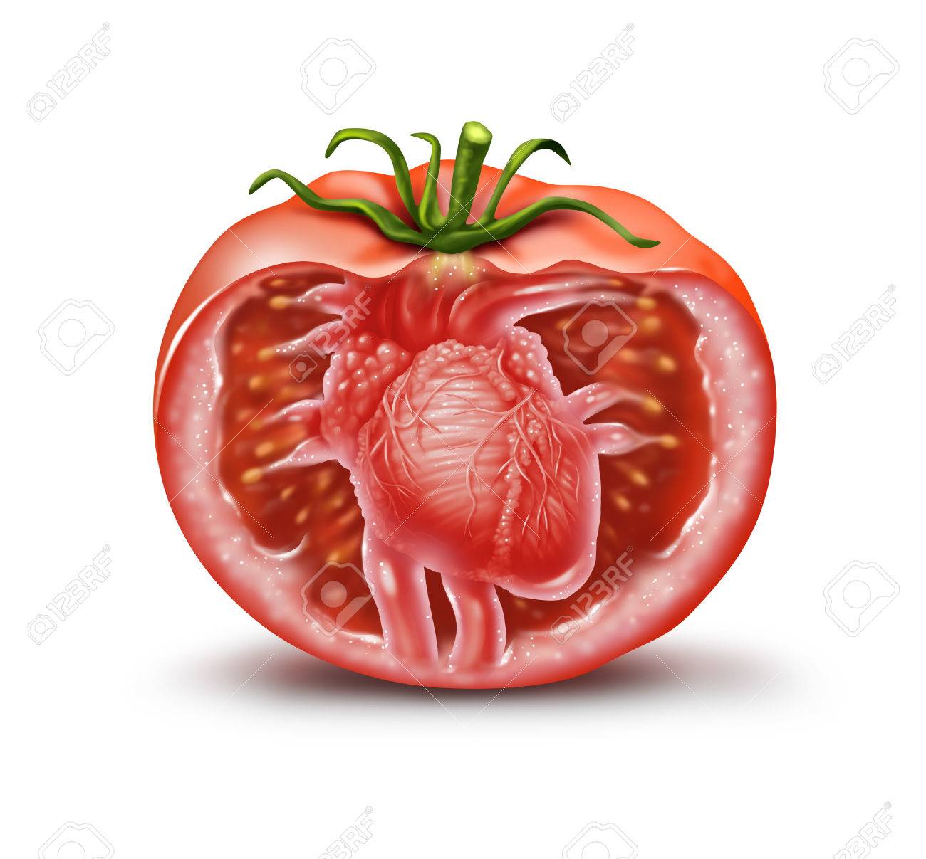 Ayudar a prevenir ataques al corazón