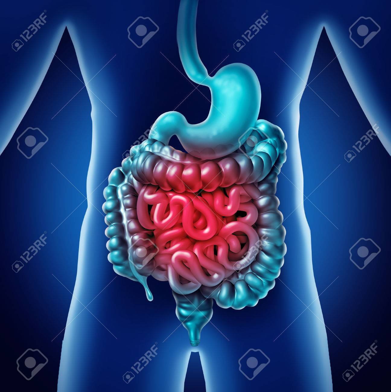 la infección renal puede causar problemas intestinales