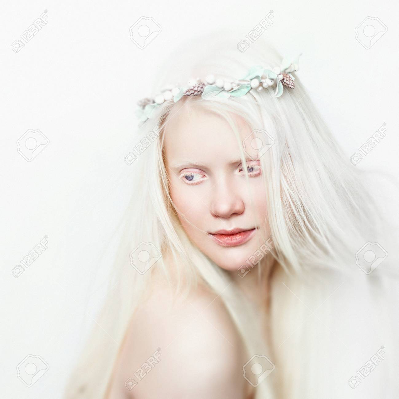 Albino Girl With White Skin, Natural Lips And White Hair. Photo Face On A  Light Background. Portrait Of The Head. Blonde Girl Stock Photo, Picture  and Royalty Free Image. Image 88542077., image size:1299x1300