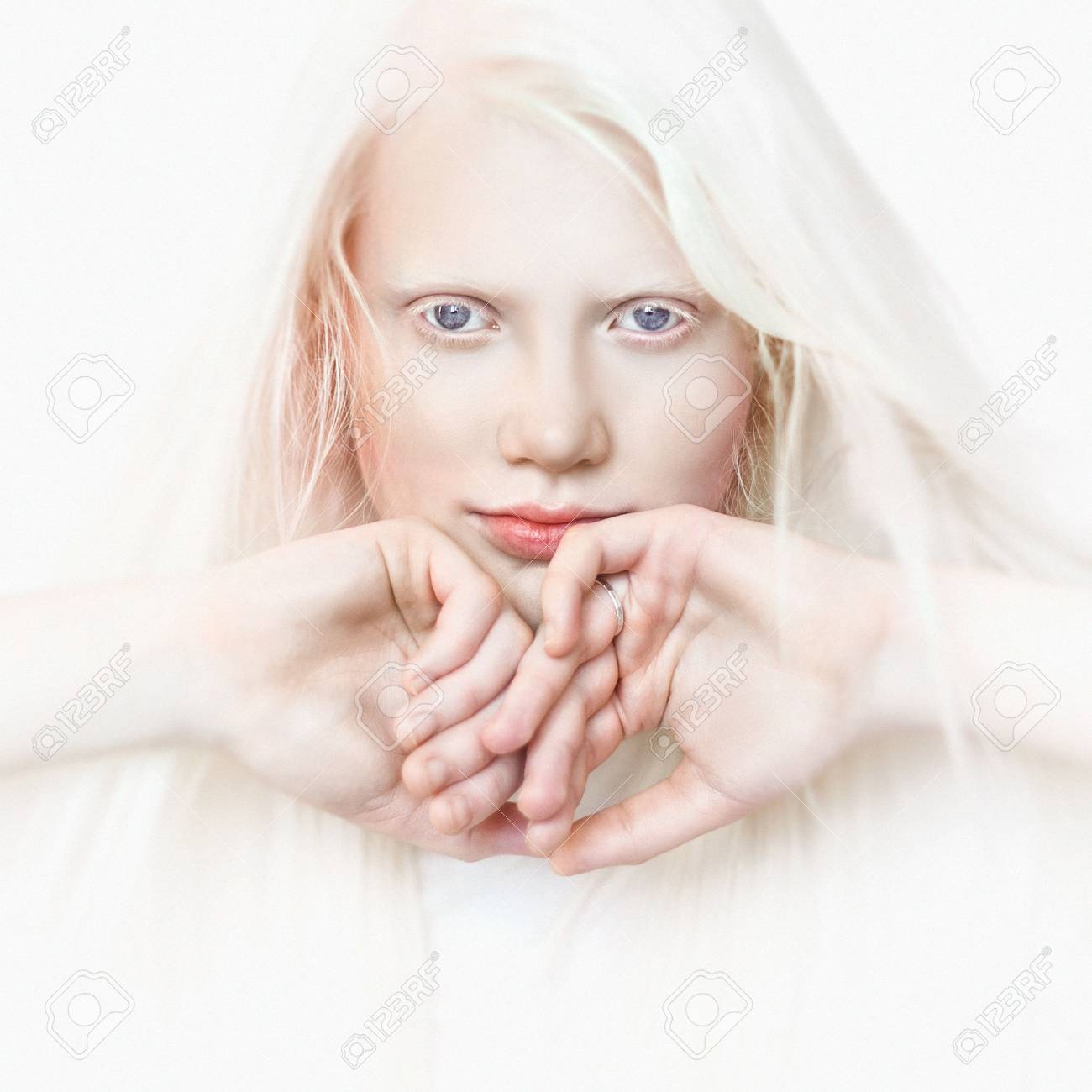 Albino Girl With White Skin, Natural Lips And White Hair. Photo Face On A  Light Background. Portrait Of The Head. Blonde Girl Stock Photo, Picture  and Royalty Free Image. Image 88542080., image size:1300x1300