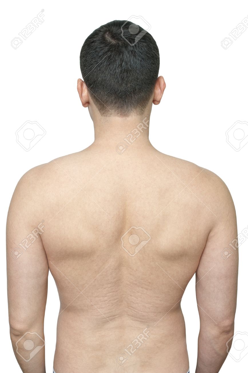 Mann dehnungsstreifen bauch