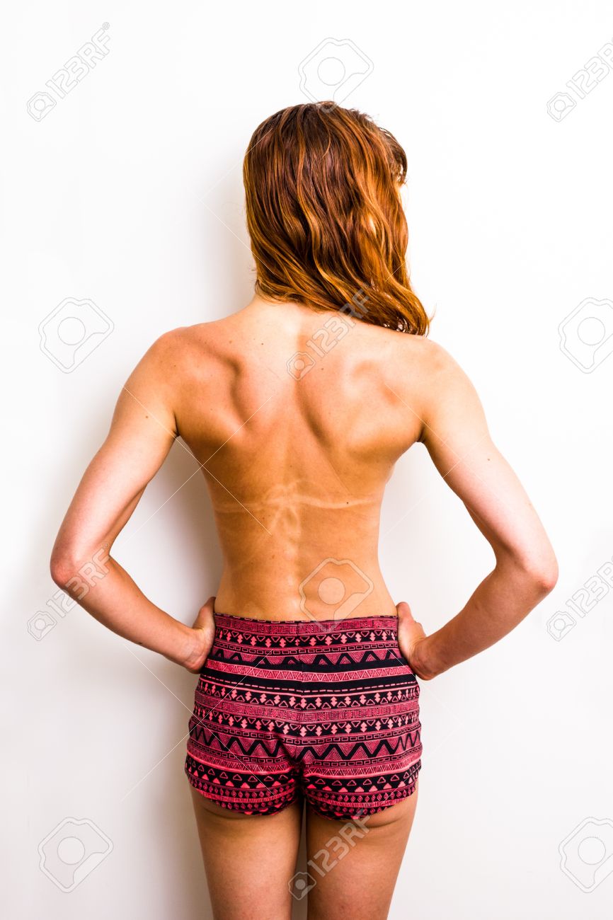 日焼けした背中とラインを持つ女性の後姿 の写真素材 画像素材 Image