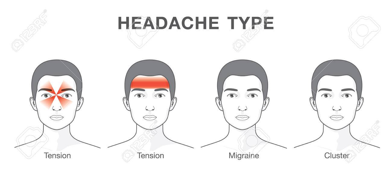 頭痛 4 を患者の頭の別の領域に入力します ヒースの心配の医療イラスト のイラスト素材 ベクタ Image