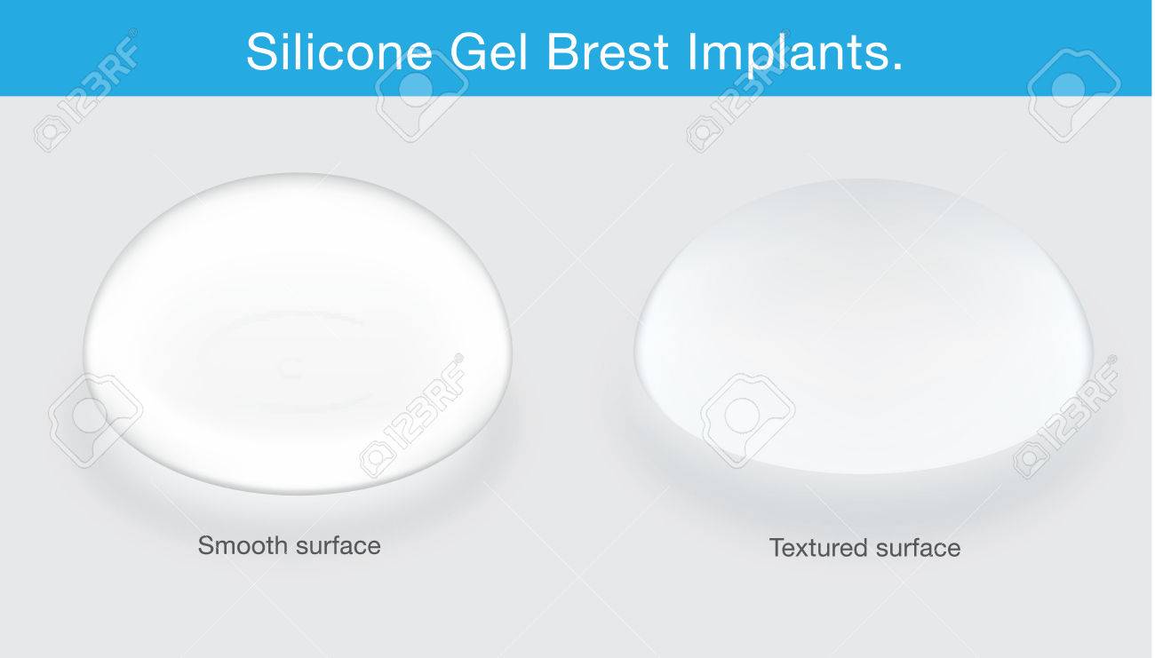 difference de texture de l implant mammaire cette illustration sur la chirurgie esthetique clip art libres de droits vecteurs et illustration image 76389840