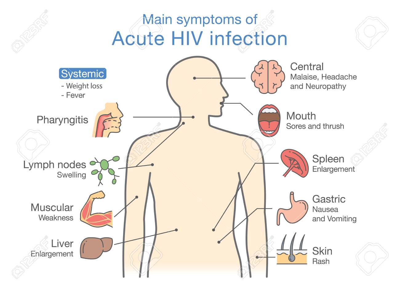 symptom för hiv symptom för hiv