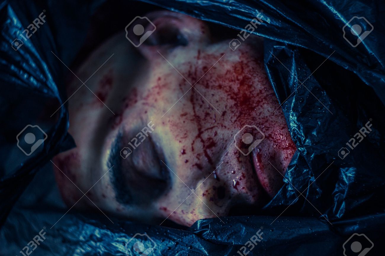 裸　死体　解剖 