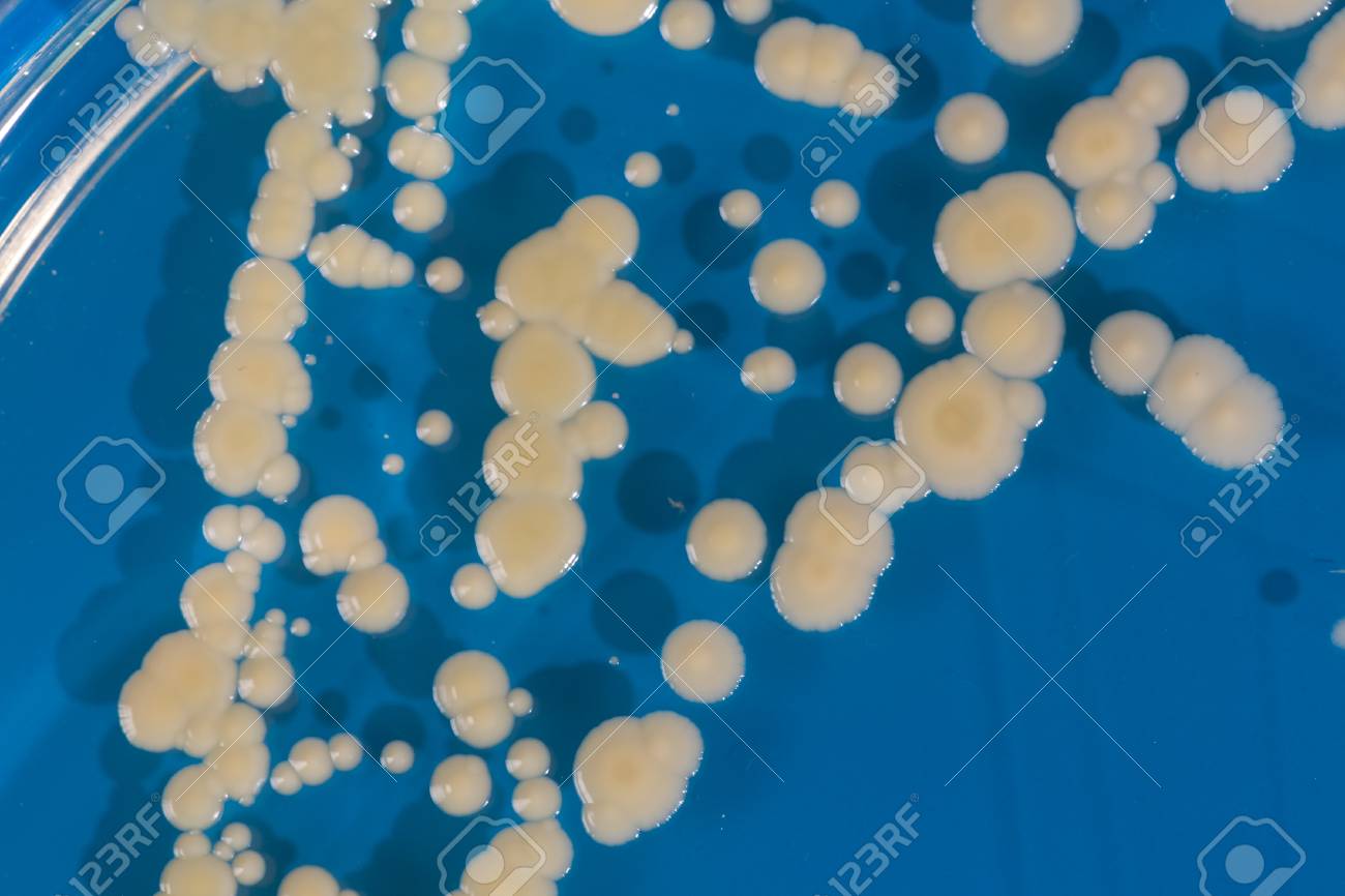 医師手 菌類 微生物で微生物の成長の文化でシャーレを杭します ペトリ皿 ペトリー皿 プレートや細胞培養シャーレ の写真素材 画像素材 Image
