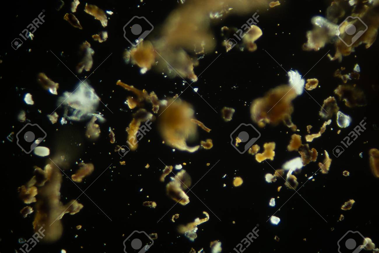 House Dust In The Microscope Stock Photo Picture And Royalty Free Image Image