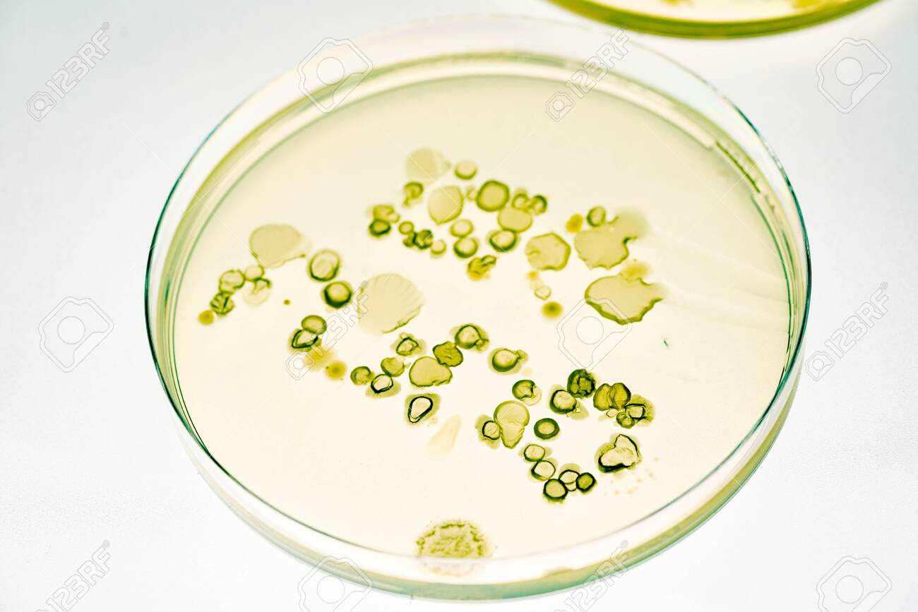 Growing Bacteria In Petri Dishes On Agar Gel Scientific Experiment Stock Photo Picture And Royalty Free Image Image 141030914