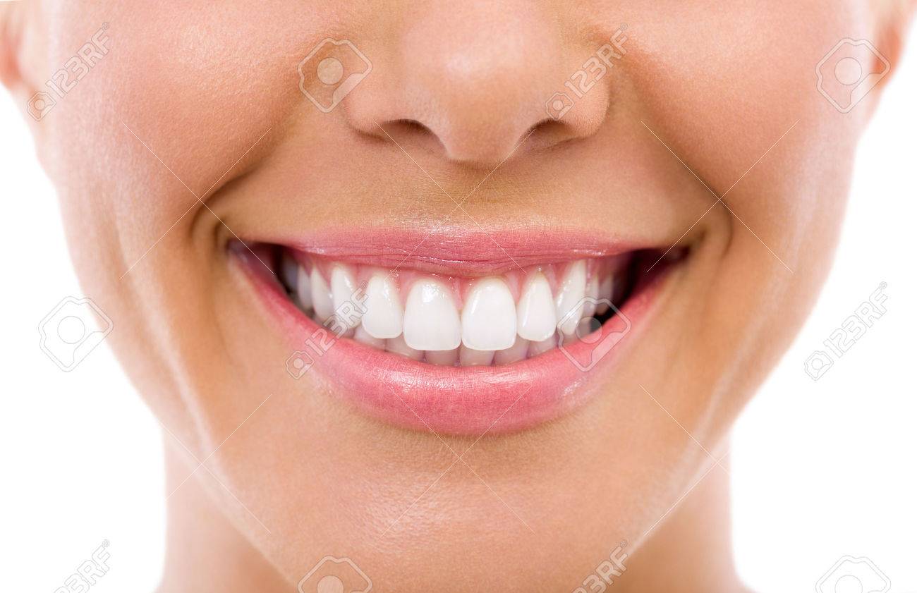 Woman smile, teeth whitening, dental care - 31581736 Woman smile, teeth whitening, dental care - 31581736