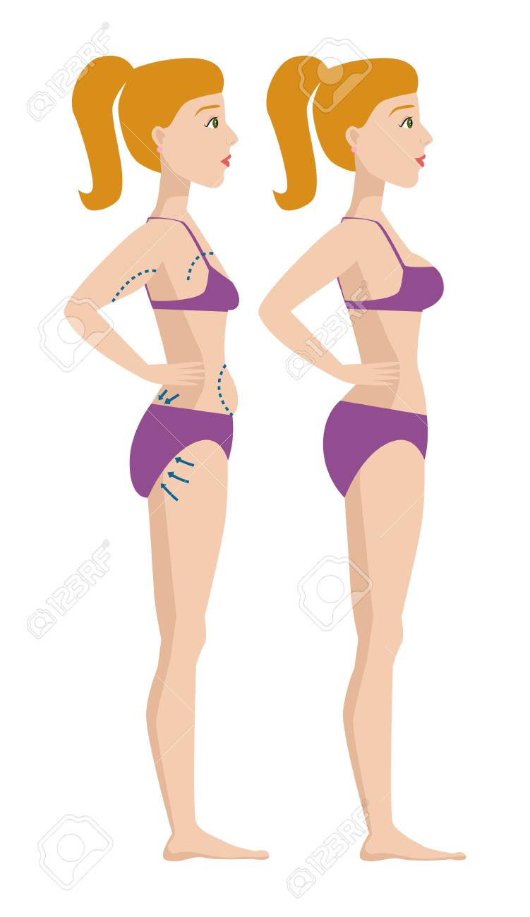 Plastic Surgery Body Parts Woman Correction Anaplasty Medicine Royalty Free Cliparts Vectors And Stock Illustration Image 86921480