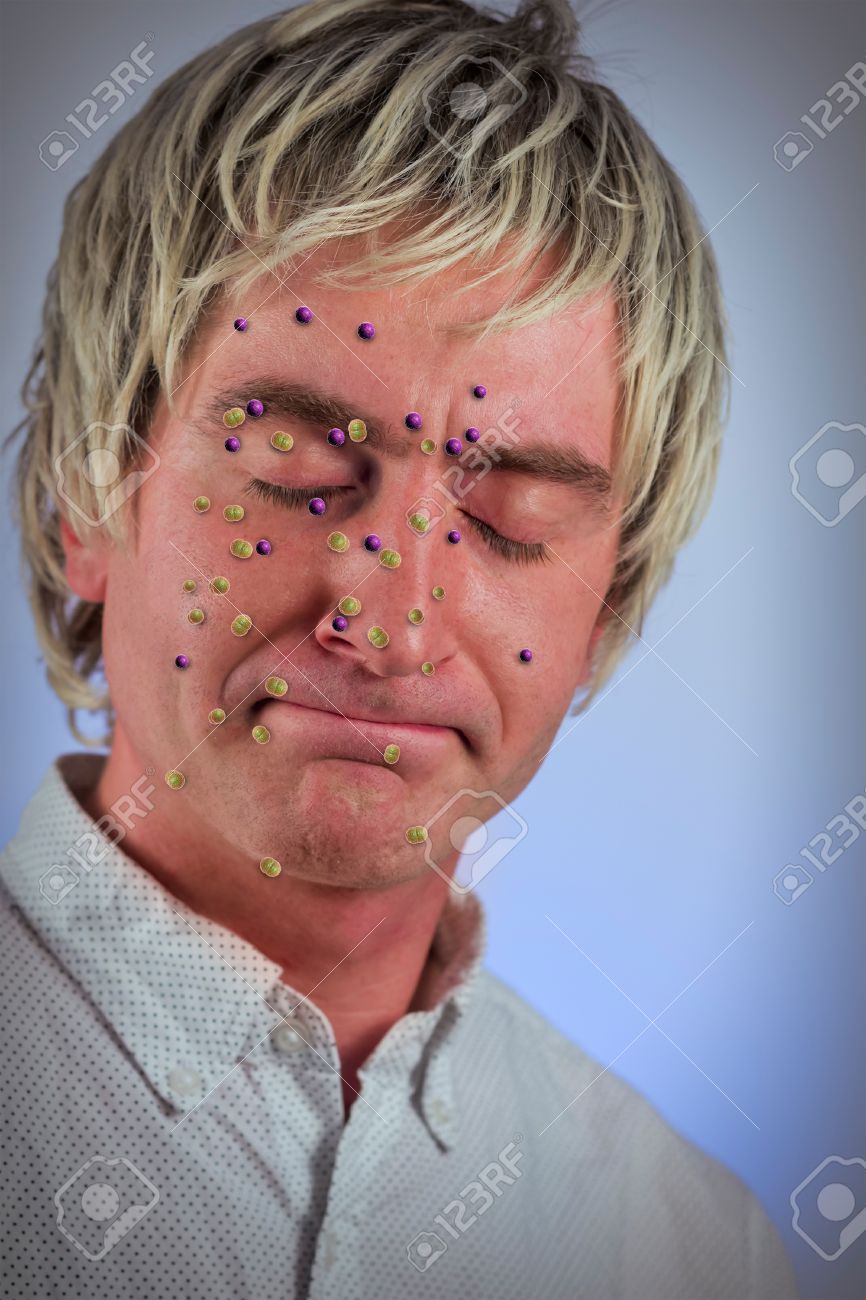金髪の髪の男の顔に細菌ウイルス病気 の写真素材 画像素材 Image 金髪の髪の男の顔に細菌ウイルス病気 の写真素材 画像素材 Image
