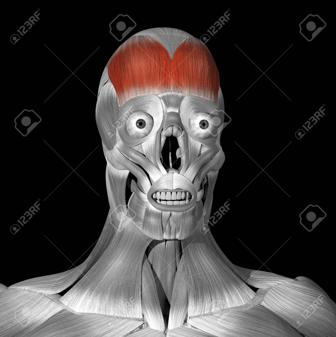 This is a 3d illustration of the Frontalis muscle - 142140489 This is a 3d illustration of the Frontalis muscle - 142140489