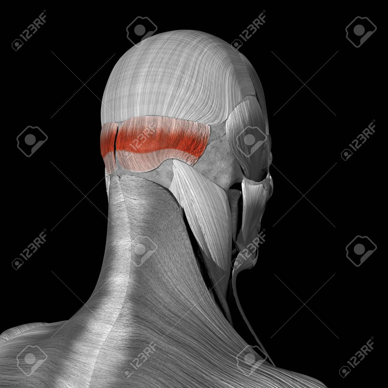 This is a 3d illustration of the occipital muscle - 142140495 This is a 3d illustration of the occipital muscle - 142140495