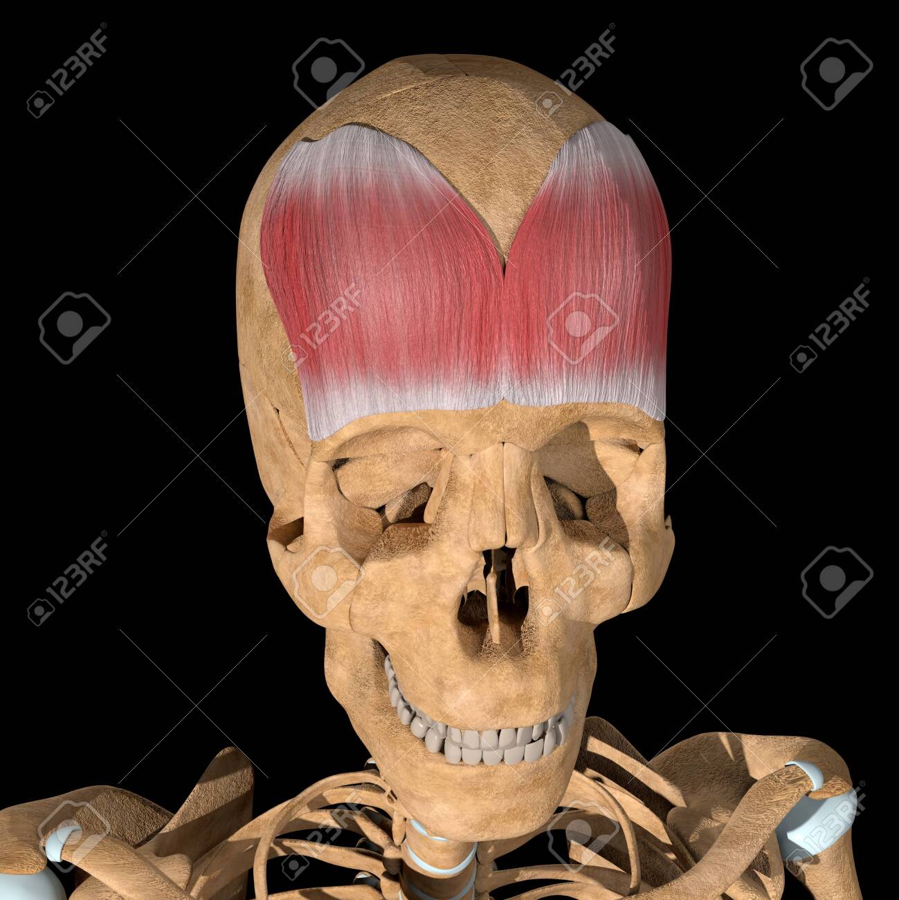 This is a 3d illustration of the Frontalis muscle on skeleton - 141461972 This is a 3d illustration of the Frontalis muscle on skeleton - 141461972