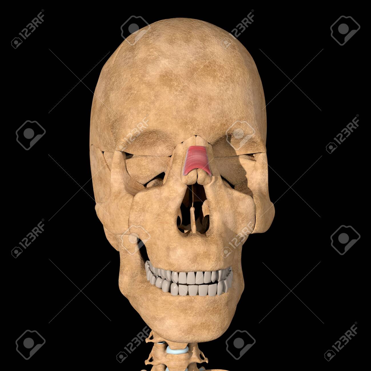 This is a 3d illustration of the nasalis muscle on skeleton - 141461815 This is a 3d illustration of the nasalis muscle on skeleton - 141461815